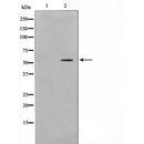 Western blot analysis of extracts from Rat lung, using PPAR-alpha Antibody. The lane on the left was treated with blocking peptide.