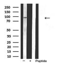 Western blot analysis of extracts from various samples, using MKL1 Antibody.
 Lane 1: Pc12 treated with blocking peptide;
 Lane 2: Pc12;
 Lane 3: 3T3.