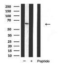 AF5303 at 1/100 staining Human prostate tissue by IHC-P. The sample was formaldehyde fixed and a heat mediated antigen retrieval step in citrate buffer was performed. The sample was then blocked and incubated with the antibody for 1.5 hours at 22¡ãC. An HRP conjugated goat anti-rabbit antibody was used as the secondary