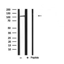 AF5304 staining HepG2 by IF/ICC. The samples were fixed with PFA and permeabilized in 0.1% Triton X-100,then blocked in 10% serum for 45 minutes at 25¡ãC. Samples were then incubated with primary Ab(AF5304 1:200) and mouse anti-beta tubulin Ab(T0023 1:200) for 1 hour at 37¡ãC. An  AlexaFluor594 conjugated goat anti-rabbit IgG(H+L) Ab(S0006 1:200 Red) and an AlexaFluor488 conjugated goat anti-mouse IgG(H+L) Ab(S0017 1:600 Green) were used as the secondary antibod