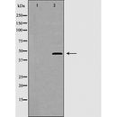 AF5306 at 1/100 staining Mouse intestine tissue by IHC-P. The sample was formaldehyde fixed and a heat mediated antigen retrieval step in citrate buffer was performed. The sample was then blocked and incubated with the antibody for 1.5 hours at 22¡ãC. An HRP conjugated goat anti-rabbit antibody was used as the secondary