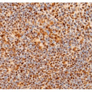 Western blot analysis of extracts from Mouse  brain, using Notch 1 (Cleaved-Val1744) Antibody. The lane on the left was treated with blocking peptide.