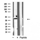 AF5308 staining 293T? cells by IF/ICC. The sample were fixed with PFA and permeabilized in 0.1% Triton X-100,then blocked in 10% serum for 45 minutes at 25¡ãC. The primary antibody was diluted at 1/200 and incubated with the sample for 1 hour at 37¡ãC. An  Alexa Fluor 594 conjugated goat anti-rabbit IgG (H+L) antibody(Cat.