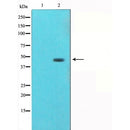 AF5309 staining HepG2 by IF/ICC. The samples were fixed with PFA and permeabilized in 0.1% Triton X-100,then blocked in 10% serum for 45 minutes at 25¡ãC. Samples were then incubated with primary Ab(AF5309 1:200) and mouse anti-beta tubulin Ab(T0023 1:200) for 1 hour at 37¡ãC. An  AlexaFluor594 conjugated goat anti-rabbit IgG(H+L) Ab(S0006 1:200 Red) and an AlexaFluor488 conjugated goat anti-mouse IgG(H+L) Ab(S0017 1:600 Green) were used as the secondary antibod