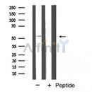 AF5313 staining HepG2 by IF/ICC. The samples were fixed with PFA and permeabilized in 0.1% Triton X-100,then blocked in 10% serum for 45 minutes at 25¡ãC. Samples were then incubated with primary Ab(AF5313 1:200) and mouse anti-beta tubulin Ab(T0023 1:200) for 1 hour at 37¡ãC. An  AlexaFluor594 conjugated goat anti-rabbit IgG(H+L) Ab(S0006 1:200 Red) and an AlexaFluor488 conjugated goat anti-mouse IgG(H+L) Ab(S0017 1:600 Green) were used as the secondary antibod