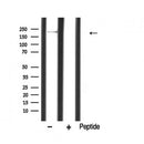Western blot analysis of extracts from mouse muscle, using MYLK Antibody.