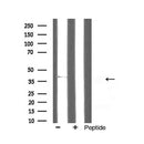 AF5316 staining HepG2 by IF/ICC. The samples were fixed with PFA and permeabilized in 0.1% Triton X-100,then blocked in 10% serum for 45 minutes at 25¡ãC. Samples were then incubated with primary Ab(AF5316 1:200) and mouse anti-beta tubulin Ab(T0023 1:200) for 1 hour at 37¡ãC. An  AlexaFluor594 conjugated goat anti-rabbit IgG(H+L) Ab(S0006 1:200 Red) and an AlexaFluor488 conjugated goat anti-mouse IgG(H+L) Ab(S0017 1:600 Green) were used as the secondary antibod