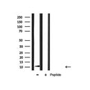 Western blot analysis of S100 A4 expression in mouse muscle tissue lysate