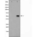 AF5321 staining HeLa by IF/ICC. The sample were fixed with PFA and permeabilized in 0.1% Triton X-100,then blocked in 10% serum for 45 minutes at 25¡ãC. The primary antibody was diluted at 1/200 and incubated with the sample for 1 hour at 37¡ãC. An  Alexa Fluor 594 conjugated goat anti-rabbit IgG (H+L) Ab, diluted at 1/600, was used as the secondary antibod