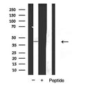 AF5322 at 1/100 staining Human lung tissue by IHC-P. The sample was formaldehyde fixed and a heat mediated antigen retrieval step in citrate buffer was performed. The sample was then blocked and incubated with the antibody for 1.5 hours at 22¡ãC. An HRP conjugated goat anti-rabbit antibody was used as the secondary