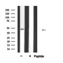 AF5323 at 1/100 staining Mouse brain tissue by IHC-P. The sample was formaldehyde fixed and a heat mediated antigen retrieval step in citrate buffer was performed. The sample was then blocked and incubated with the antibody for 1.5 hours at 22¡ãC. An HRP conjugated goat anti-rabbit antibody was used as the secondary