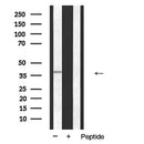 Western blot analysis of ANXA1 expression in K562 cells