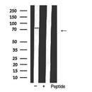 AF5331 at 1/100 staining Human liver tissue by IHC-P. The sample was formaldehyde fixed and a heat mediated antigen retrieval step in citrate buffer was performed. The sample was then blocked and incubated with the antibody for 1.5 hours at 22¡ãC. An HRP conjugated goat anti-rabbit antibody was used as the secondary