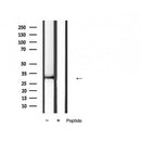 AF5333 at 1/100 staining Human lung tissue by IHC-P. The sample was formaldehyde fixed and a heat mediated antigen retrieval step in citrate buffer was performed. The sample was then blocked and incubated with the antibody for 1.5 hours at 22¡ãC. An HRP conjugated goat anti-rabbit antibody was used as the secondary