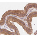 Western blot analysis of extracts from various samples, using Catenin  alpha 1 Antibody.
 Lane 1: Mouse liver treated with blocking peptide;
 Lane 2: Mouse liver;
 Lane 3: Hepg2.