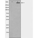 AF5340 at 1/100 staining Mouse brain tissue by IHC-P. The sample was formaldehyde fixed and a heat mediated antigen retrieval step in citrate buffer was performed. The sample was then blocked and incubated with the antibody for 1.5 hours at 22¡ãC. An HRP conjugated goat anti-rabbit antibody was used as the secondary