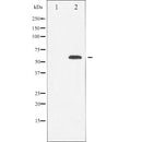 Western blot analysis of extracts from various samples, using FAS Antibody.
 Lane 1: Mouse lung treated with blocking peptide;
 Lane 2: Mouse lung;
 Lane 3: Mouse brain.