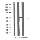 AF5343 at 1/100 staining Human urothelial cancer tissue by IHC-P. The sample was formaldehyde fixed and a heat mediated antigen retrieval step in citrate buffer was performed. The sample was then blocked and incubated with the antibody for 1.5 hours at 22¡ãC. An HRP conjugated goat anti-rabbit antibody was used as the secondary