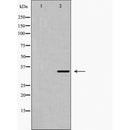 AF5345 at 1/100 staining Mouse brain tissue by IHC-P. The sample was formaldehyde fixed and a heat mediated antigen retrieval step in citrate buffer was performed. The sample was then blocked and incubated with the antibody for 1.5 hours at 22¡ãC. An HRP conjugated goat anti-rabbit antibody was used as the secondary