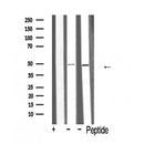 AF5349 at 1/100 staining Human gastric tissue by IHC-P. The sample was formaldehyde fixed and a heat mediated antigen retrieval step in citrate buffer was performed. The sample was then blocked and incubated with the antibody for 1.5 hours at 22¡ãC. An HRP conjugated goat anti-rabbit antibody was used as the secondary