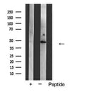 AF5351 staining COLO205? cells by IF/ICC. The sample were fixed with PFA and permeabilized in 0.1% Triton X-100,then blocked in 10% serum for 45 minutes at 25¡ãC. The primary antibody was diluted at 1/200 and incubated with the sample for 1 hour at 37¡ãC. An  Alexa Fluor 594 conjugated goat anti-rabbit IgG (H+L) antibody(Cat.