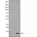 AF5352 at 1/100 staining Human uterus tissue by IHC-P. The sample was formaldehyde fixed and a heat mediated antigen retrieval step in citrate buffer was performed. The sample was then blocked and incubated with the antibody for 1.5 hours at 22¡ãC. An HRP conjugated goat anti-rabbit antibody was used as the secondary