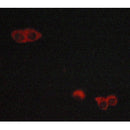 AF5355 at 1/100 staining Human Melanoma tissue by IHC-P. The sample was formaldehyde fixed and a heat mediated antigen retrieval step in citrate buffer was performed. The sample was then blocked and incubated with the antibody for 1.5 hours at 22¡ãC. An HRP conjugated goat anti-rabbit antibody was used as the secondary