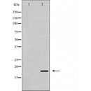 AF5356 staining Hela by IF/ICC. The sample were fixed with PFA and permeabilized in 0.1% Triton X-100,then blocked in 10% serum for 45 minutes at 25¡ãC. The primary antibody was diluted at 1/200 and incubated with the sample for 1 hour at 37¡ãC. An  Alexa Fluor 594 conjugated goat anti-rabbit IgG (H+L) Ab, diluted at 1/600, was used as the secondary antibod