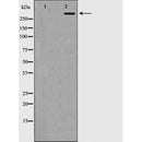 AF5360 at 1/100 staining Mouse brain tissue by IHC-P. The sample was formaldehyde fixed and a heat mediated antigen retrieval step in citrate buffer was performed. The sample was then blocked and incubated with the antibody for 1.5 hours at 22¡ãC. An HRP conjugated goat anti-rabbit antibody was used as the secondary