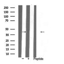 AF5361 at 1/100 staining Mouse lung tissue by IHC-P. The sample was formaldehyde fixed and a heat mediated antigen retrieval step in citrate buffer was performed. The sample was then blocked and incubated with the antibody for 1.5 hours at 22¡ãC. An HRP conjugated goat anti-rabbit antibody was used as the secondary
