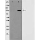 Western blot analysis of extracts from VERO, using Calnexin Antibody. The lane on the left was treated with blocking peptide.
