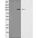 AF5365 staining HepG2 by IF/ICC. The sample were fixed with PFA and permeabilized in 0.1% Triton X-100,then blocked in 10% serum for 45 minutes at 25¡ãC. The primary antibody was diluted at 1/200 and incubated with the sample for 1 hour at 37¡ãC. An  Alexa Fluor 594 conjugated goat anti-rabbit IgG (H+L) Ab, diluted at 1/600, was used as the secondary antibod
