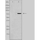 Western blot analysis of extracts from Mouse  muscle, using GRP78 Antibody. The lane on the left was treated with blocking peptide.