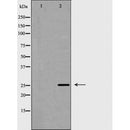 AF5367 at 1/100 staining Mouse liver tissue by IHC-P. The sample was formaldehyde fixed and a heat mediated antigen retrieval step in citrate buffer was performed. The sample was then blocked and incubated with the antibody for 1.5 hours at 22¡ãC. An HRP conjugated goat anti-rabbit antibody was used as the secondary