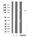 AF5368 at 1/100 staining Mouse lung tissue by IHC-P. The sample was formaldehyde fixed and a heat mediated antigen retrieval step in citrate buffer was performed. The sample was then blocked and incubated with the antibody for 1.5 hours at 22¡ãC. An HRP conjugated goat anti-rabbit antibody was used as the secondary