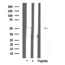 AF5370 staining sw480 cells by IF/ICC. The sample were fixed with PFA and permeabilized in 0.1% Triton X-100,then blocked in 10% serum for 45 minutes at 25¡ãC. The primary antibody was diluted at 1/200 and incubated with the sample for 1 hour at 37¡ãC. An  Alexa Fluor 594 conjugated goat anti-rabbit IgG (H+L) antibody(Cat.