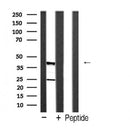 Western blot analysis of CASP4 (p20, Cleaved-Gln81)  expression in Jurkat cells