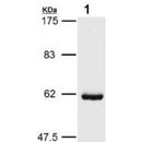Western blot analysis of extracts from various samples, using HSP60 Antibody.
 Lane 1: B16F10 treated with blocking peptide;
 Lane 2: B16F10;
 Lane 3: Hela;
 Lane 4: VERO;
 Lane 5: Myeloma cells.