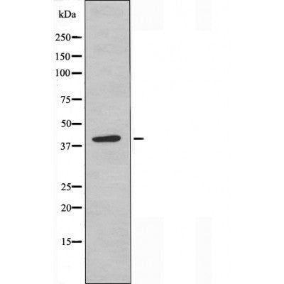Western blot analysis of SOCS-1 expression in JK cells