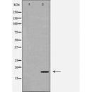 AF5381 at 1/100 staining Rat heart tissue by IHC-P. The sample was formaldehyde fixed and a heat mediated antigen retrieval step in citrate buffer was performed. The sample was then blocked and incubated with the antibody for 1.5 hours at 22¡ãC. An HRP conjugated goat anti-rabbit antibody was used as the secondary