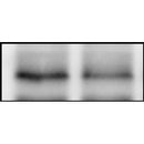 Western blot analysis of extracts from various samples, using P62/SQSTM1 Antibody.
 Lane 1: Myeloma cells treated with blocking peptide;
 Lane 2: Myeloma cells;
 Lane 3: HUVEC.
