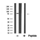 Western blot analysis of extracts from various samples, using FOXP2 Antibody.
 Lane 1: Hela, treated with blocking peptide;
 Lane 2: Hela;
 Lane 3: Mouse  spleen;
 Lane 4: COS-7.