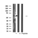 AF5389 at 1/100 staining Mouse liver tissue by IHC-P. The sample was formaldehyde fixed and a heat mediated antigen retrieval step in citrate buffer was performed. The sample was then blocked and incubated with the antibody for 1.5 hours at 22¡ãC. An HRP conjugated goat anti-rabbit antibody was used as the secondary