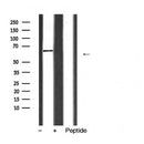 Western blot analysis of Cytochrome P450 2D6 expression in etal liver cell lysate
