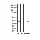 Western blot analysis of extracts from Hybridoma cells, using HO-1 Antibody. The lane on the left was treated with blocking peptide.
