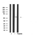 Western blot analysis of extracts from various samples, using HNF1 beta Antibody.
 Lane 1: B16F10 treated with blocking peptide;
 Lane 2: B16F10;
 Lane 3: Myeloma cells;
 Lane 4: MCF7.