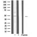 AF5396 at 1/100 staining Human prostate tissue by IHC-P. The sample was formaldehyde fixed and a heat mediated antigen retrieval step in citrate buffer was performed. The sample was then blocked and incubated with the antibody for 1.5 hours at 22¡ãC. An HRP conjugated goat anti-rabbit antibody was used as the secondary