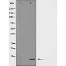 AF5403 at 1/100 staining Human uterus tissue by IHC-P. The sample was formaldehyde fixed and a heat mediated antigen retrieval step in citrate buffer was performed. The sample was then blocked and incubated with the antibody for 1.5 hours at 22¡ãC. An HRP conjugated goat anti-rabbit antibody was used as the secondary