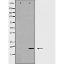 AF5405 staining Hela by IF/ICC. The sample were fixed with PFA and permeabilized in 0.1% Triton X-100,then blocked in 10% serum for 45 minutes at 25¡ãC. The primary antibody was diluted at 1/200 and incubated with the sample for 1 hour at 37¡ãC. An  Alexa Fluor 594 conjugated goat anti-rabbit IgG (H+L) Ab, diluted at 1/600, was used as the secondary antibod