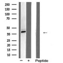 AF5406 staining HeLa by IF/ICC. The sample were fixed with PFA and permeabilized in 0.1% Triton X-100,then blocked in 10% serum for 45 minutes at 25¡ãC. The primary antibody was diluted at 1/200 and incubated with the sample for 1 hour at 37¡ãC. An  Alexa Fluor 594 conjugated goat anti-rabbit IgG (H+L) Ab, diluted at 1/600, was used as the secondary antibod